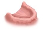 Cherry Hill Dental Excellence | Orthodontics, Dental Emergencies and Cosmetic Dentistry