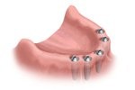 Cherry Hill Dental Excellence | Oral & Maxillofacial Surgery, Dental Cleanings and Prevention and Periodontal Disease