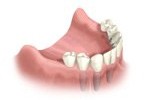 Cherry Hill Dental Excellence | Endodontics, Restorative Dentistry and Dental Exams and Cleanings