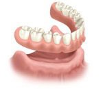 Cherry Hill Dental Excellence | Botox for TMJ and Headache Pain, Dental Emergencies and Periodontal Disease