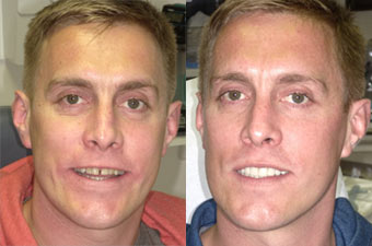 Cherry Hill Dental Excellence | Cosmetic Dentistry, Periodontal Disease and Dental Cleanings and Prevention
