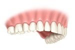 Cherry Hill Dental Excellence | Endodontics, Dental Emergencies and Dental Exams and Cleanings