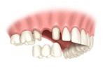 Cherry Hill Dental Excellence | Restorative Dentistry, Orthodontics and Oral   Maxillofacial Surgery