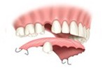 Cherry Hill Dental Excellence | Periodontics, Periodontal Disease and Endodontics