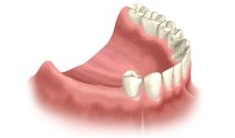 Cherry Hill Dental Excellence | Oral   Maxillofacial Surgery, Periodontics and Restorative Dentistry
