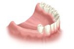 Cherry Hill Dental Excellence | Periodontal Disease, Dental Cleanings and Prevention and Oral   Maxillofacial Surgery