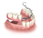 Cherry Hill Dental Excellence | Endodontics, Periodontal Disease and Dental Exams and Cleanings